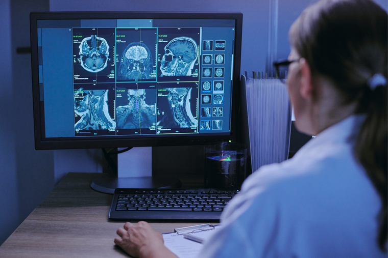 Un chercheur regardant un écran, évaluant des scans du cerveau et de la moelle épinière